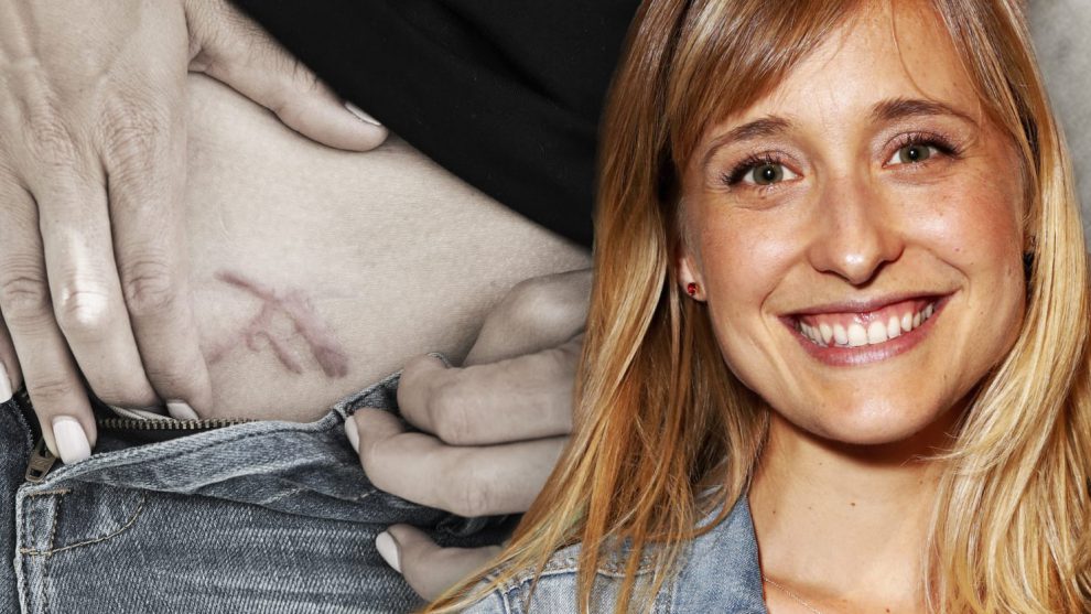 Allison Mack