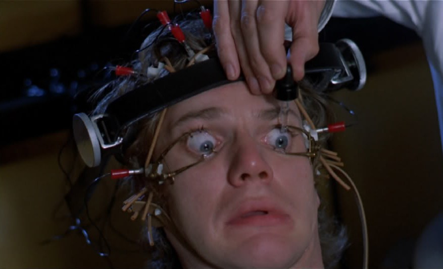 a clockwork orange torture2