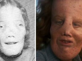 rocky dennis
