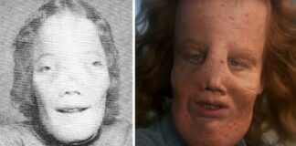 rocky dennis