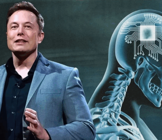 Elon